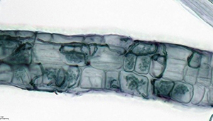 Microscope photograph showing a colonised root