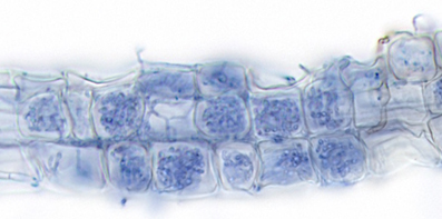 Microscope photograph showing mycorrhizal fungi colonising heather root